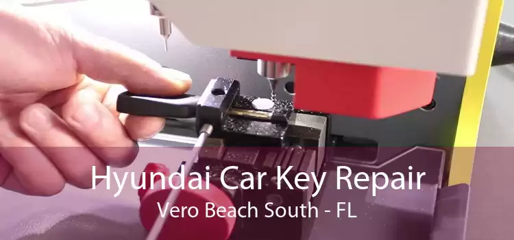 Hyundai Car Key Repair Vero Beach South - FL